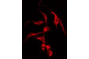 ABIN6274606 staining COLO205 by IF/ICC.