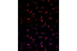 Immunofluorescence analysis of L929 cells using MEK7 antibody (ABIN3023156, ABIN3023157, ABIN3023158 and ABIN6219416) at dilution of 1:100.