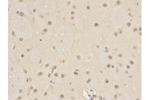 Immunohistochemistry (IHC) image for anti-Autophagy related 4A Cysteine Peptidase (ATG4A) antibody (ABIN1871138) (ATG4A anticorps)