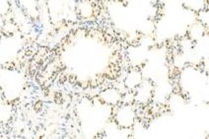 Immunohistochemistry analysis of paraffin-embedded rat lung using,IOP2 (ABIN7074883) at dilution of 1: 2000 (NARF anticorps)