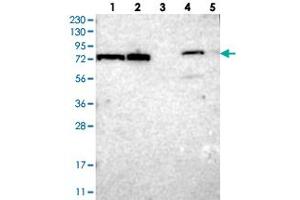 Western blot analysis of Lane 1: RT-4, Lane 2: U-251 MG, Lane 3: Human Plasma, Lane 4: Liver, Lane 5: Tonsil with TTC14 polyclonal antibody  at 1:250-1:500 dilution. (TTC14 anticorps)