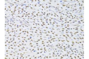 Immunohistochemistry of paraffin-embedded human adenomyosis using FKBP4 Antibody (ABIN5973289) at dilution of 1/100 (40x lens). (FKBP4 anticorps)