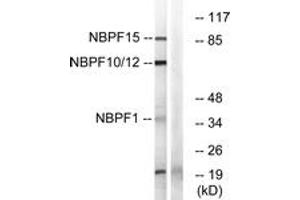 Western blot analysis of extracts from 293/HepG2/Jurkat/COLO cells, using NBPF1/9/10/12/14/15/16/20 Antibody. (NBPF1,9,10,12,14,15,16,20 (AA 121-150) anticorps)