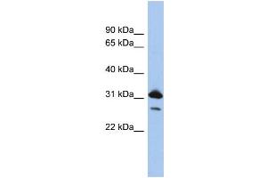 WB Suggested Anti-RAP1B  Antibody Titration: 0. (RAP1B anticorps  (N-Term))