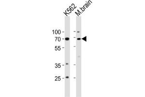 Western Blotting (WB) image for anti-Tumor Protein P73 (TP73) antibody (ABIN3003949)
