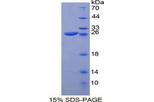 Image no. 1 for SP100 Nuclear Antigen (SP100) (AA 116-333) protein (His tag) (ABIN6237942) (SP100 Protein (AA 116-333) (His tag))