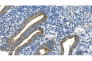 IHC analysis of DRP1/DNM1L using anti-DRP1/DNM1L antibody (ABIN7602180). (Dynamin 1-Like anticorps  (AA 618-736))