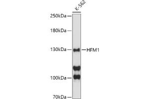 Western blot analysis of extracts of K-562 cells, using HFM1 antibody (ABIN6133318, ABIN6141741, ABIN6141743 and ABIN6224711) at 1:500 dilution. (HFM1 anticorps  (AA 1-240))