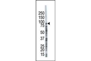 Image no. 1 for anti-Ubiquitin Specific Peptidase 8 (USP8) (C-Term) antibody (ABIN357537) (USP8 anticorps  (C-Term))