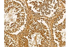 ABIN6262098 and ABIN6269010 at 1/100 staining Rat testis tissue by IHC-P. (HSPA9 anticorps  (C-Term))
