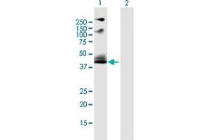 Western Blot analysis of ADRB2 expression in transfected 293T cell line by ADRB2 MaxPab polyclonal antibody. (beta 2 Adrenergic Receptor anticorps  (AA 1-413))