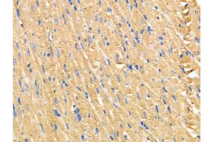 ABIN6258272 and ABIN6274405 at 1/100 staining Rat heart tissue by IHC-P.