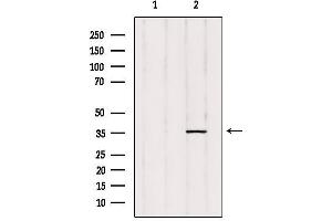 Western blot analysis of extracts from rat heart, using ZADH1 Antibody.