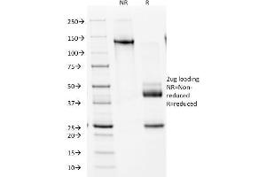 SDS-PAGE Analysis Purified NKX2.