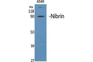 Western Blot (WB) analysis of specific cells using Nibrin Polyclonal Antibody.