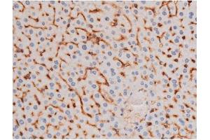 ABIN6267485 at 1/200 staining Mouse liver tissue sections by IHC-P.