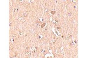 Immunohistochemical staining of human brain tissue with 2. (MED28 anticorps  (Internal Region))