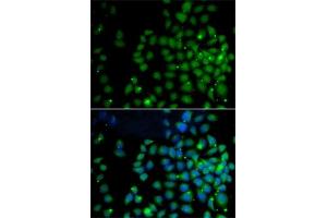 Immunofluorescence analysis of A-549 cells using F/F/UBD antibody (ABIN6131598, ABIN6149778, ABIN6149780 and ABIN6221159). (UBD anticorps  (AA 1-165))