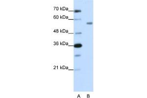 WB Suggested Anti-ZNF497 Antibody Titration:  1. (ZNF497 anticorps  (N-Term))