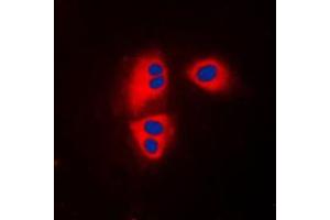 anti-Mitochondrial Ribosomal Protein L32 (MRPL32) (Center) antibody