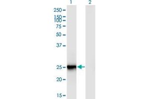 Western Blot analysis of FIGLA expression in transfected 293T cell line by FIGLA monoclonal antibody (M03), clone 6A10. (FIGLA anticorps  (AA 110-219))