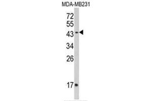 Western blot analysis of IFNGR2 Antibody (C-term) in MDA-MB435 cell line lysates (35ug/lane). (IFNGR2 anticorps  (C-Term))