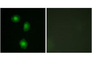 Immunofluorescence analysis of A549 cells, using MSK1 (Ab-376) Antibody. (MSK1 anticorps  (AA 343-392))