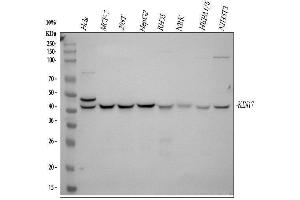 anti-KIN, Antigenic Determinant of RecA Protein Homolog (KIN) (AA 3-202) antibody