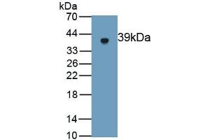 Detection of Recombinant GSDMD, Rat using Polyclonal Antibody to Gasdermin D (GSDMD) (GSDMD anticorps  (AA 1-326))