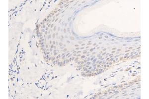 ABIN6267268 at 1/100 staining human skin tissue sections by IHC-P.