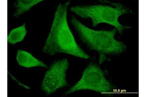 Immunofluorescence of monoclonal antibody to EIF2S2 on HeLa cell.