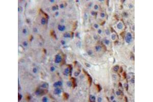 IHC-P analysis of Liver tissue, with DAB staining. (ADAM8 anticorps  (AA 145-493))