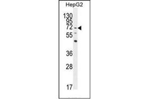 Western blot analysis of LRRC33 Antibody (C-term) in HepG2 cell line lysates (35ug/lane). (LRRC33 anticorps  (C-Term))