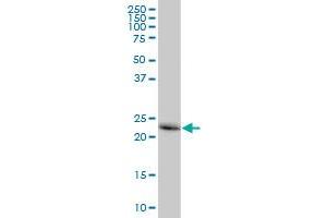 CTSB MaxPab polyclonal antibody.