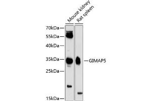 Western blot analysis of extracts of various cell lines, using GIM antibody (ABIN6127954, ABIN6141085, ABIN6141086 and ABIN6224753) at 1:3000 dilution. (GIMAP5 anticorps  (AA 190-270))