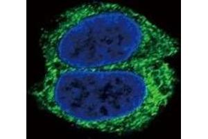 Confocal immunofluorescent analysis of TGFBR2 antibody with HepG2 cells followed by Alexa Fluor 488-conjugated goat anti-rabbit lgG (green).