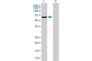 Western Blot analysis of KRT79 expression in transfected 293T cell line by KRT79 MaxPab polyclonal antibody. (Cytokeratin 79 anticorps  (AA 1-535))
