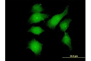 Immunofluorescence of monoclonal antibody to FGFR1OP on HeLa cell. (FGFR1OP anticorps  (AA 1-379))
