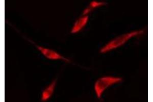 ABIN6275728 staining  LOVO cells by IF/ICC. (THO Complex 4 anticorps  (Internal Region))