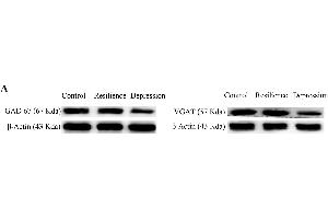 GABA synthesis, uptake and release are impaired in the nucleus accumbens of CUMS-induced depression mice, but not resilience miceThe expression and relative quantity of proteins GAD-67 and VGAT were studied by western-blot. (beta Actin anticorps)