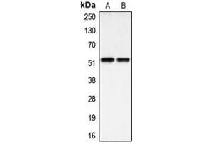 Western blot analysis of BMP3A expression in HEK293T (A), HuvEc (B) whole cell lysates. (BMP3 anticorps  (Center))