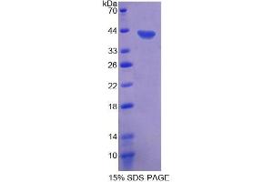 SDS-PAGE analysis of Human CD9 Protein.