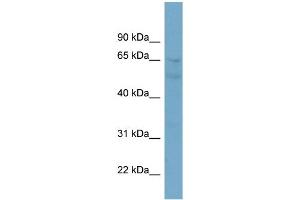 WB Suggested Anti-ZNF671 Antibody Titration:  0. (ZNF671 anticorps  (N-Term))