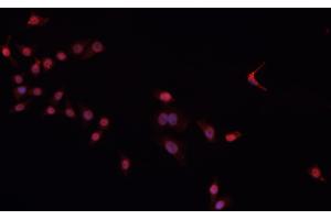 ABIN6266604 staining Daudi cells by IF/ICC. (Oct-2 anticorps)