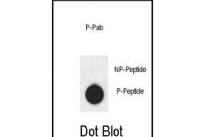 Dot blot analysis of anti-AKT1- Phospho-specific Pab (ABIN6241037 and ABIN6578932) on nitrocellulose membrane.