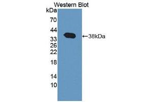 Western blot analysis of the recombinant protein. (TNS3 anticorps  (AA 1-301))