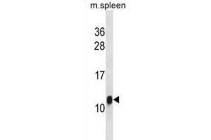 Western Blotting (WB) image for anti-Fc Fragment of IgE, High Affinity I, Receptor For, gamma Polypeptide (FCER1G) antibody (ABIN3001206) (FCER1G anticorps)