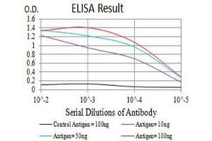 Black line: Control Antigen (100 ng),Purple line: Antigen (10 ng), Blue line: Antigen (50 ng), Red line:Antigen (100 ng) (CCR5 anticorps)