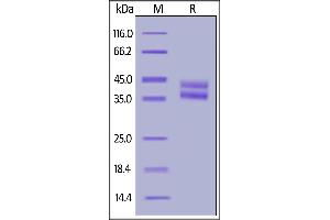 Biotinylated Human IL-2 R beta, His,Avitag on  under reducing (R) condition.