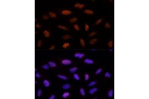 anti-Activity-Dependent Neuroprotector Homeobox (ADNP) (AA 843-1102) antibody